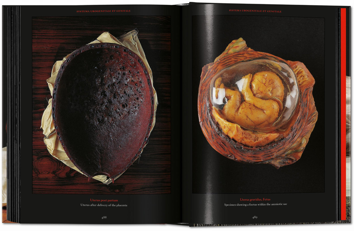 Anatomical Waxes. 45th Ed. (German, French, English) Book
