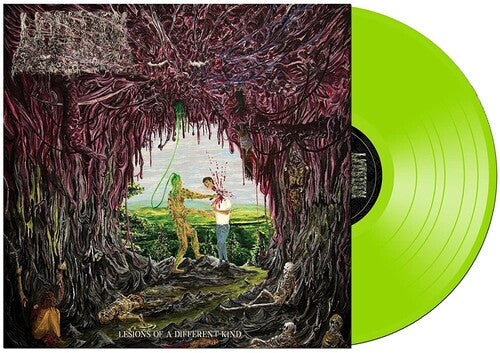 Undeath - Lesions Of A Different Kind Vinyl Record