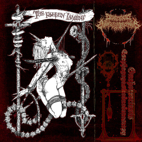 Onchocerciasis Esophagogastroduodenoscopy - Fallen Lament - Music CD