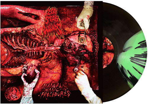 200 Stab Wounds - Manual Manic Procedures Vinyl Record