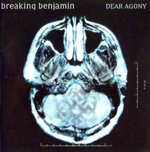 Dear Agony Music CD