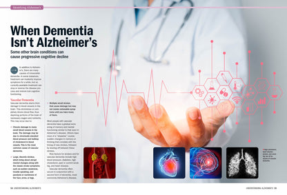 Harvard Health -  Alzheimer's Disease:  A Complete Guide To Reduce Risks, Treatment Options, Symptoms, Therapies, Support Strategies, Preventative Care, Medications, Understanding Alzheimer's & More!
