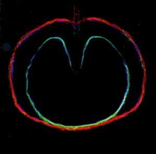 Xtc - Wasp Star (apple Venus Vol. Ii) - Music CD
