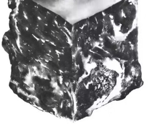 Against Me - Transgender Dysphoria Blues [10th Anniversary Edition] Vinyl Record