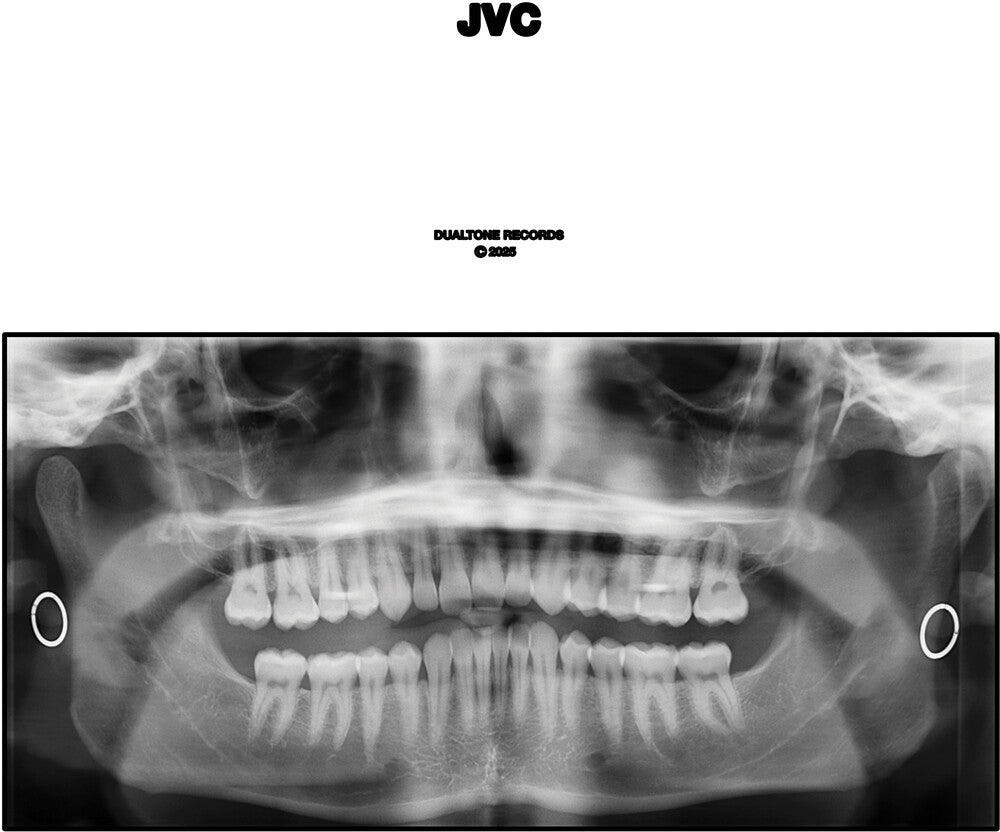Jvc [LP] Vinyl Record