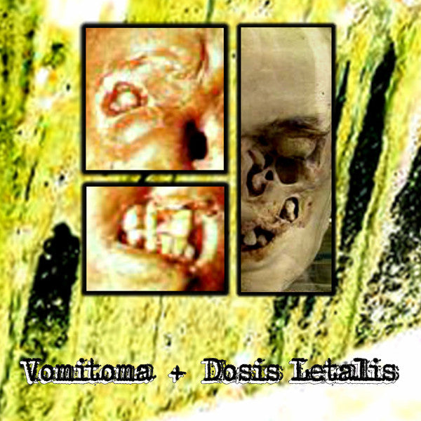 Vomitoma + Dosis Letalis – Painting The Walls With Vomit Cassette Tape