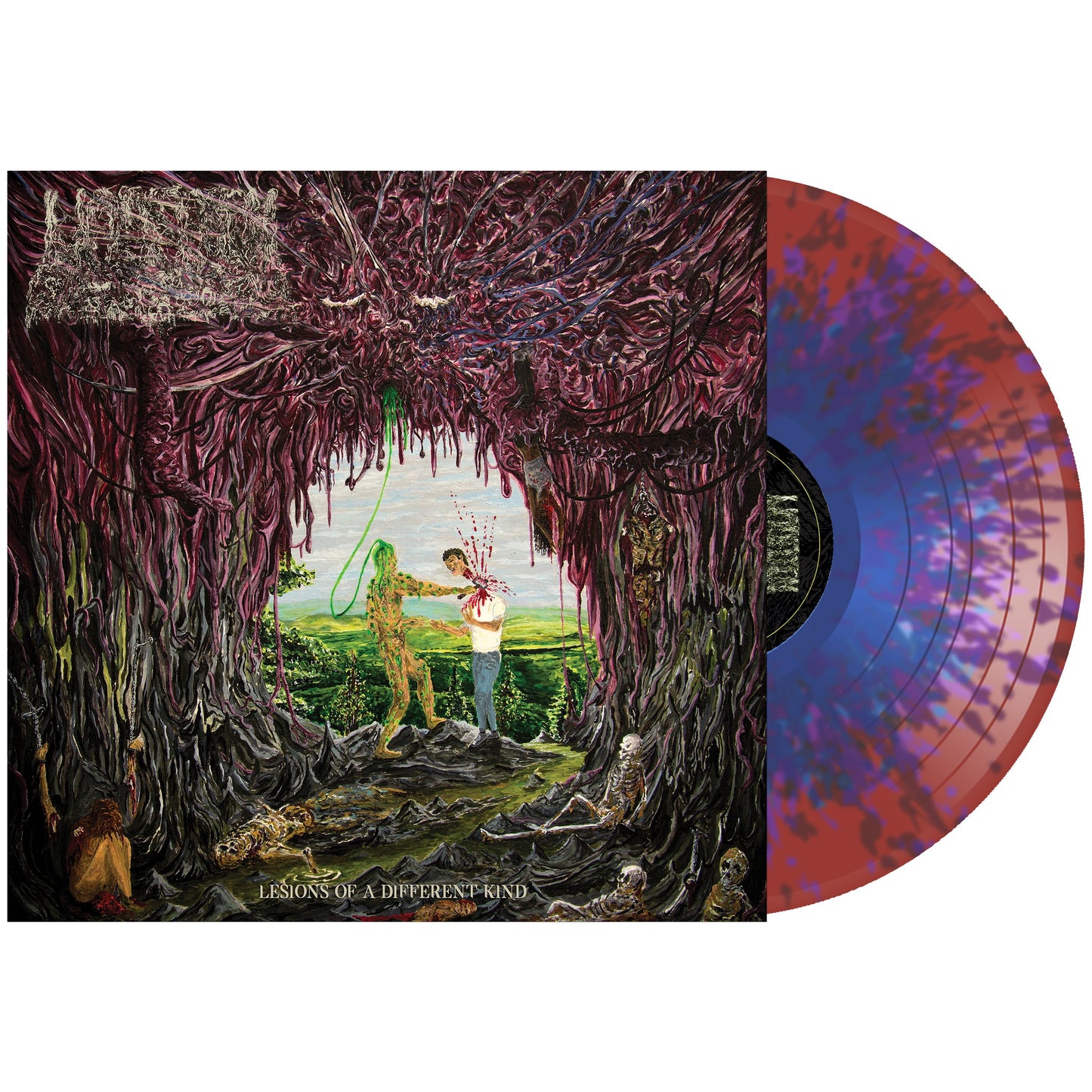 Undeath - Lesions of A Different Kind on Vinyl Record