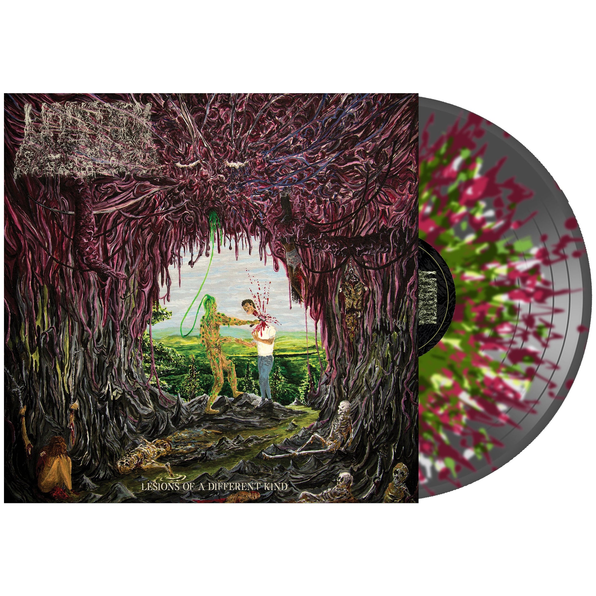 Undeath - Lesions of A Different Kind on Vinyl Record