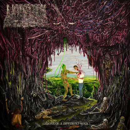 Undeath - Lesions of a Different Kind Music CD