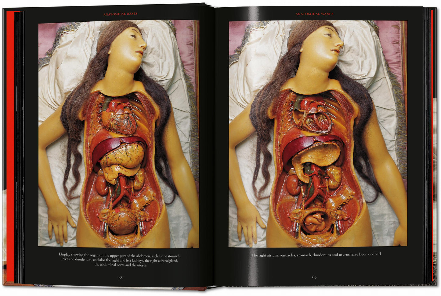 Anatomical Waxes. 45th Ed. (German, French, English) Book