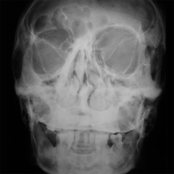 KHOLA COSMICA - Khola Cosmica Vinyl Record